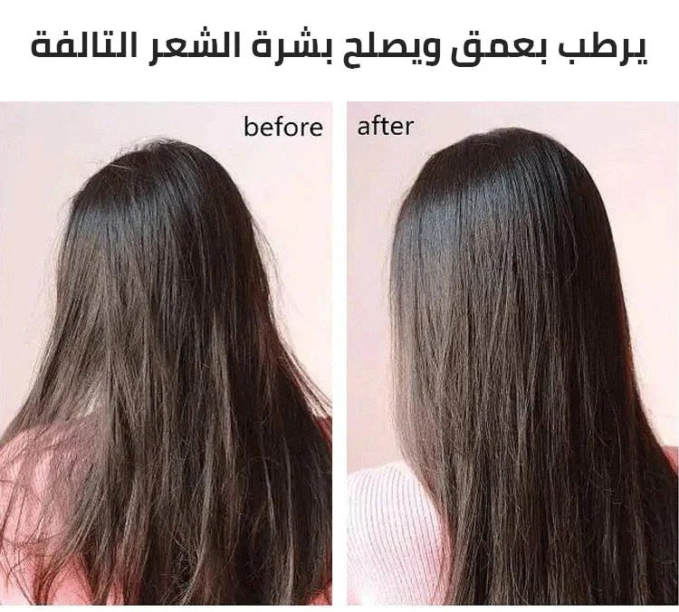 سيروم مغذي للشعر 🌙