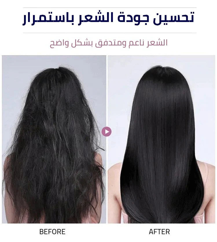 سيروم مغذي للشعر 🌙